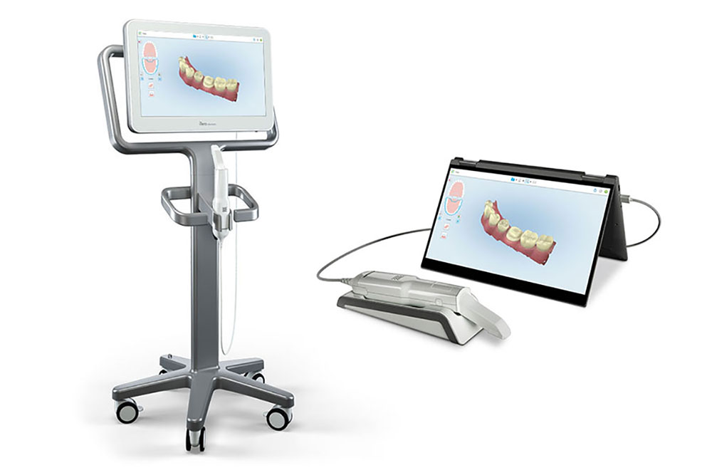 iTero Scans iTero Scans